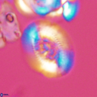 Gaarderella granulifera 12895