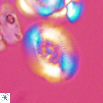 Gaarderella granulifera 12895