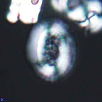 Gaarderella granulifera 12896