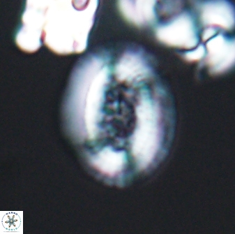 Gaarderella granulifera 12896