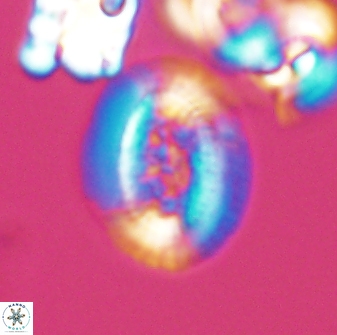 Gaarderella granulifera 12897