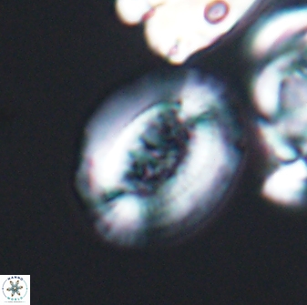 Gaarderella granulifera 12898