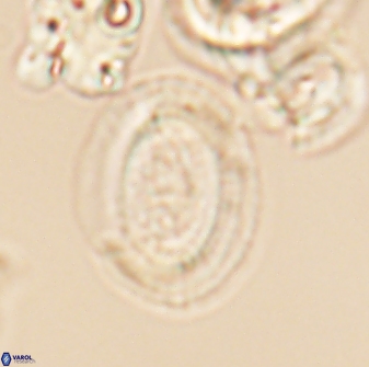 Gaarderella granulifera 12900