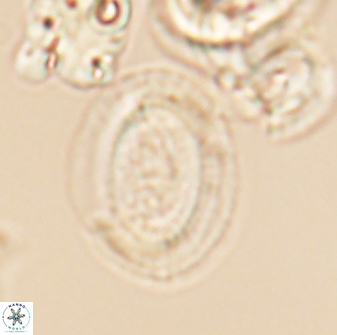 Gaarderella granulifera 12900