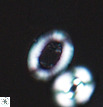 Gaarderella santacruzensis 9677