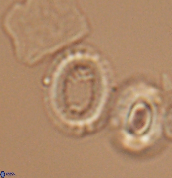 Gaarderella santacruzensis 9679