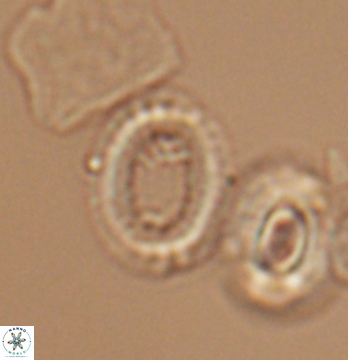 Gaarderella santacruzensis 9679
