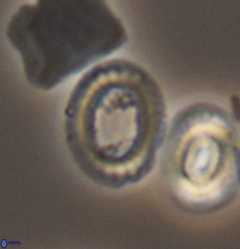 Gaarderella santacruzensis 9680