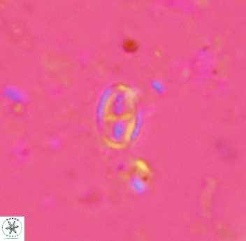 Gartnerago margaritatus 4639