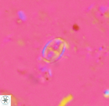 Gartnerago margaritatus 4644