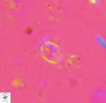 Gartnerago margaritatus 4642