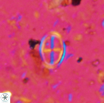 Gartnerago margaritatus 36259
