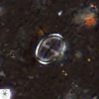 Gartnerago margaritatus 36260