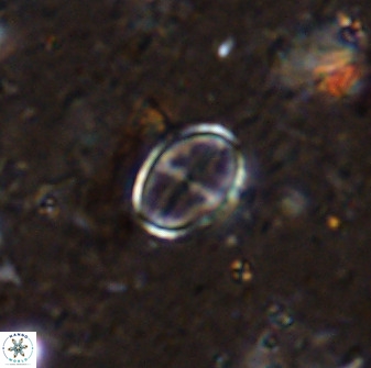 Gartnerago margaritatus 36261