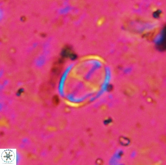 Gartnerago margaritatus 36262