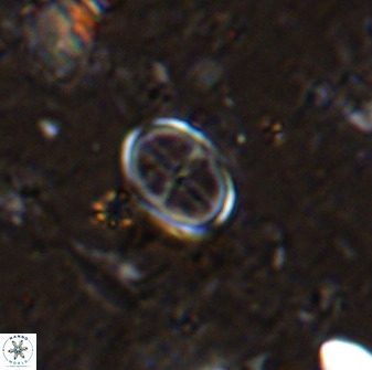 Gartnerago margaritatus 36263