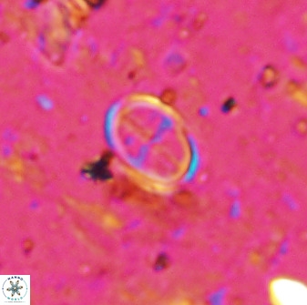 Gartnerago margaritatus 36264