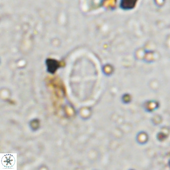 Gartnerago margaritatus 36265