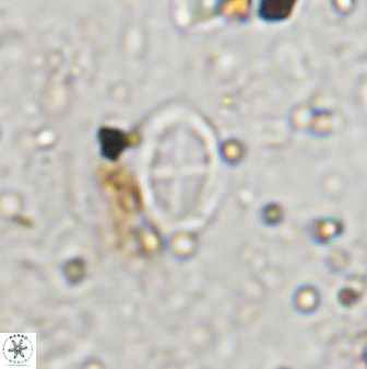 Gartnerago margaritatus 36266