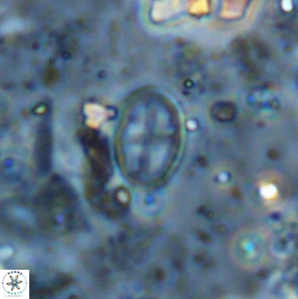 Gartnerago margaritatus 36267