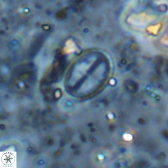 Gartnerago margaritatus 36268