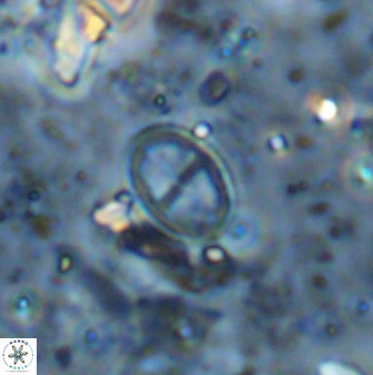 Gartnerago margaritatus 36269