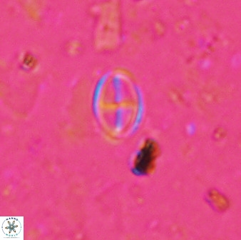 Gartnerago margaritatus 37328