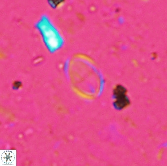 Gartnerago margaritatus 37330