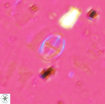 Gartnerago margaritatus 37332