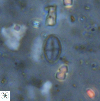 Gartnerago margaritatus 37336