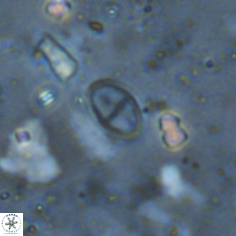 Gartnerago margaritatus 37338
