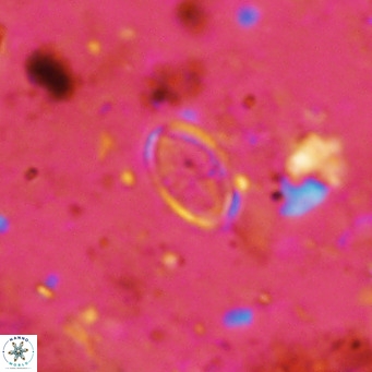 Gartnerago margaritatus VR 12643