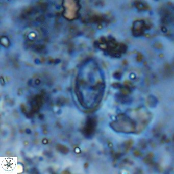 Gartnerago margaritatus VR 12651
