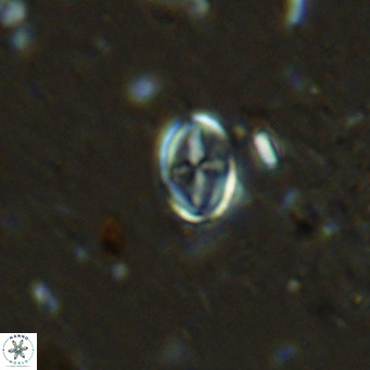 Gartnerago margaritatus VR 12985