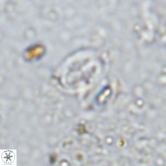 Gartnerago margaritatus VR 12996