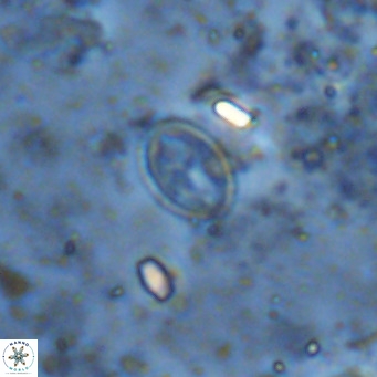 Gartnerago margaritatus VR 12999
