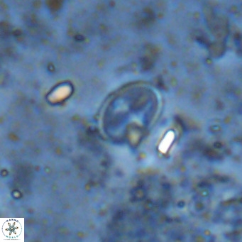 Gartnerago margaritatus VR 13001