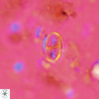 Gartnerago margaritatus VR 13104