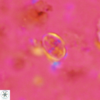 Gartnerago margaritatus VR 13107