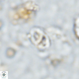 Gartnerago margaritatus VR 13116