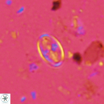 Gartnerago margaritatus VR 13249