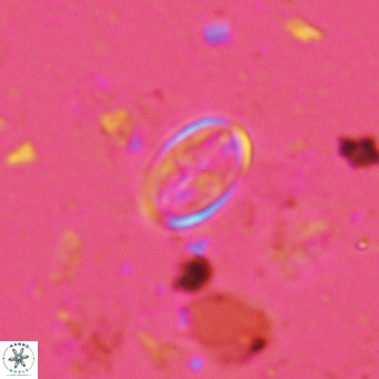 Gartnerago margaritatus VR 13255