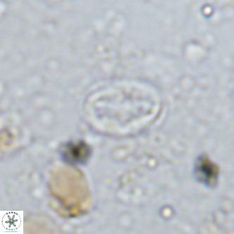 Gartnerago margaritatus VR 13258