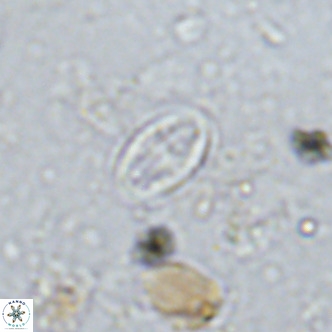 Gartnerago margaritatus VR 13259