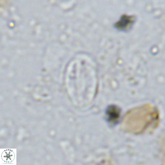 Gartnerago margaritatus VR 13260