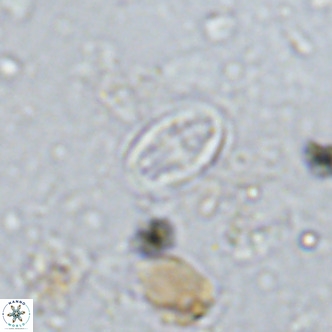 Gartnerago margaritatus VR 13261
