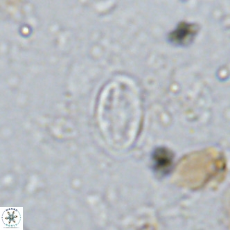 Gartnerago margaritatus VR 13262