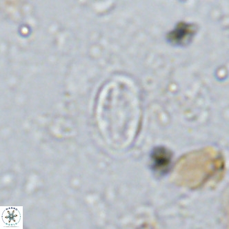 Gartnerago margaritatus VR 13263