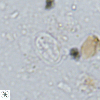 Gartnerago margaritatus VR 13264