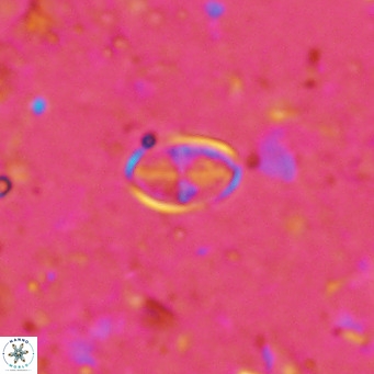 Gartnerago margaritatus VR 13552